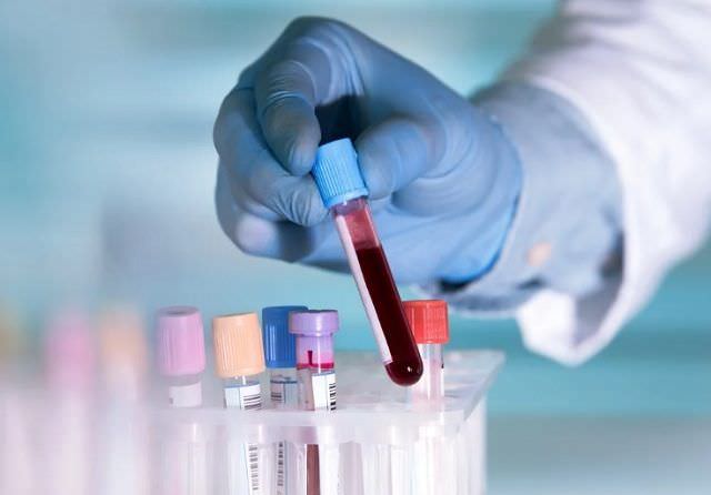 9-positif-covid-19-di-bali-rsup-sanglah-mulai-lakukan-rapid-test
