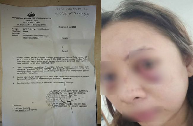 kerap-jadi-samsak-hidup-ibu-rumah-tangga-di-buleleng-polisikan-suami