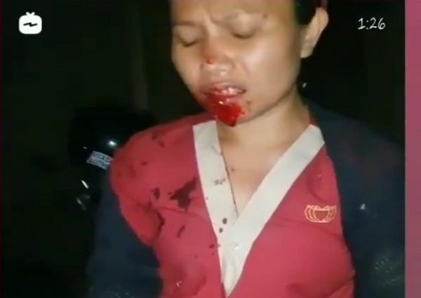 omg-pulang-kerja-cewek-muda-dijambret-pelaku-misterius-di-kerobokan