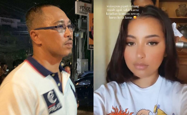 Terduga pelaku penganiayaan Jennifer Coppen (foto kiri). Foto kanan Jennifer Coppen memposting di instatory dirinya usai dianiaya. (IG @jennifercoppenreal20).