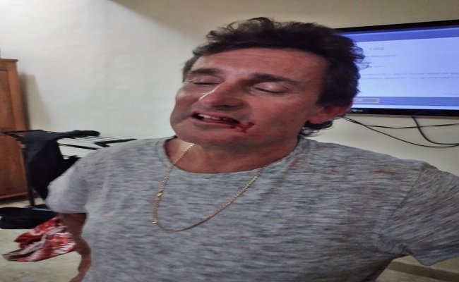 Michael David Cordell, warga asal Australia yang kini ditahan. (ist)