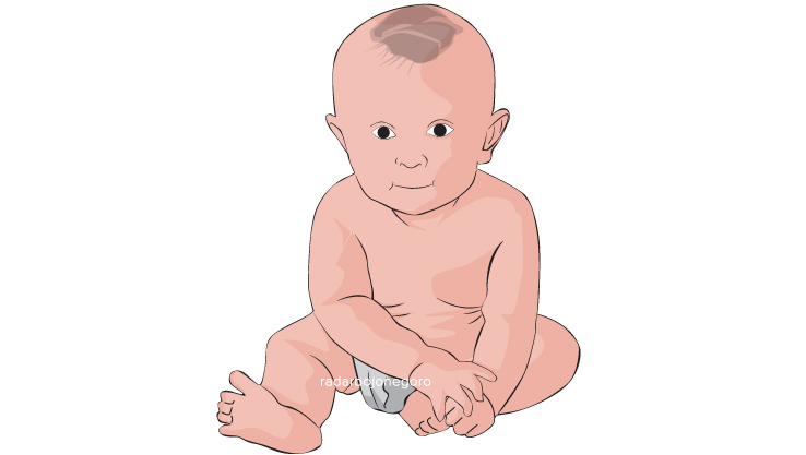 Ilustrasi bayi Resiko Stunting (Ainur Ochiem/RDR.BJN)