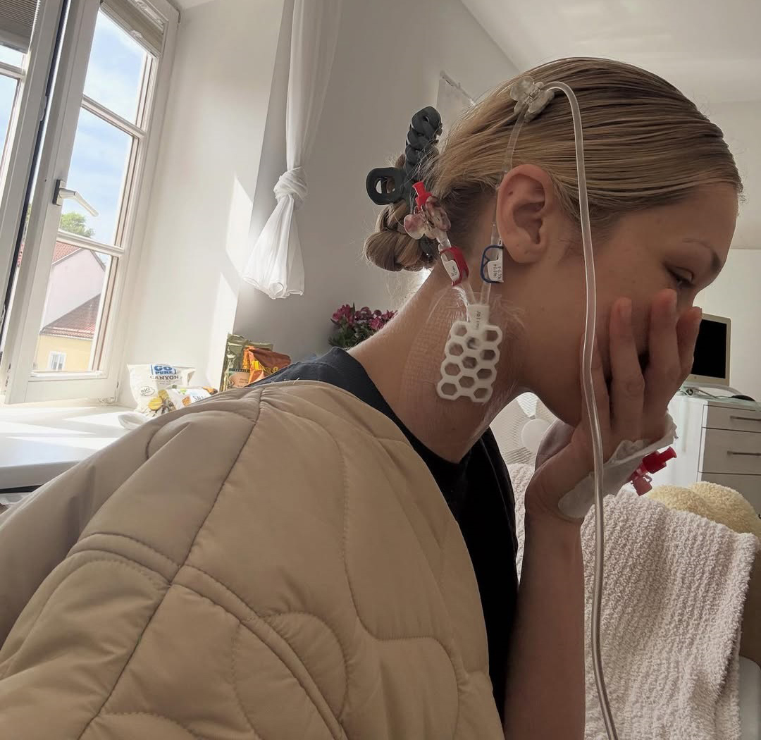 Bella Hadid menunjukkan perawatan penyakit Lyme yang dijalankannya. (Instagram Bella Hadid)
