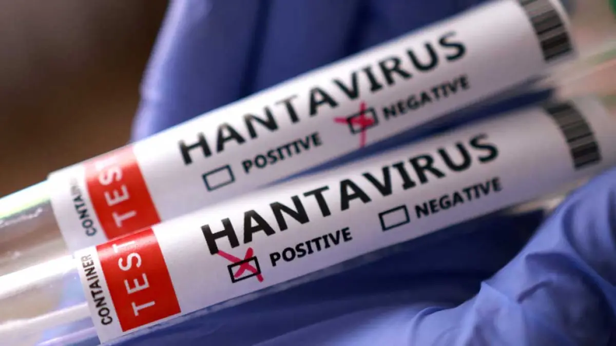 HANTAVIRUS: Ancaman pandemi hantavirus 2026 mengintai.