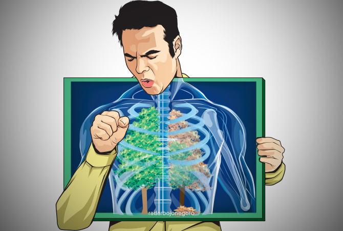 ILUSTRASI  TBC (AINUR OCHIEM/RDR/BJN)