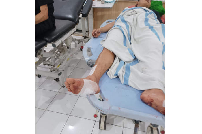 Dua anggota gangster yang terlibat tawuran dirawat karena luka bacok.