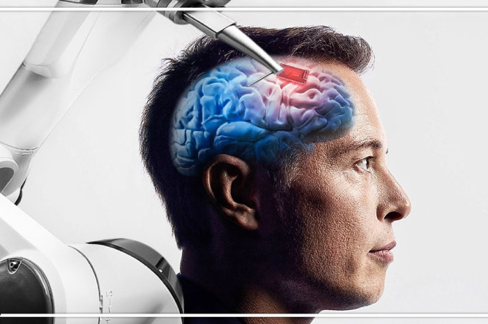 Ilustrasi mesin robot Neuralink chip implan dari Elon Musk.
