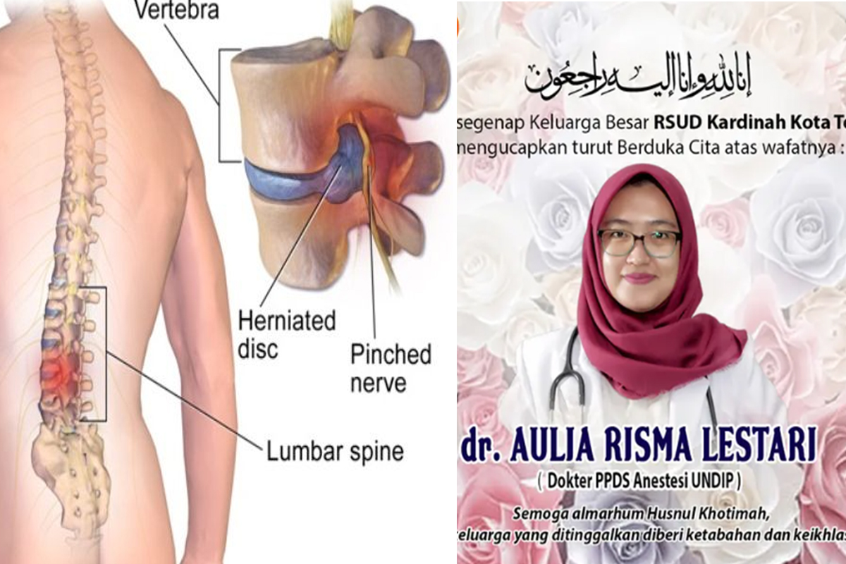 Riwayat penyakit yang dimiliki oleh Aulia Risma Lestari dokter muda PPDS anestesi Undip Semarang.