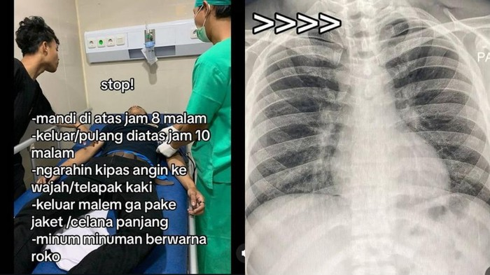 Viral dimedia sosial yang memperlihatkan seorang pria yang terkena paru-paru basah.