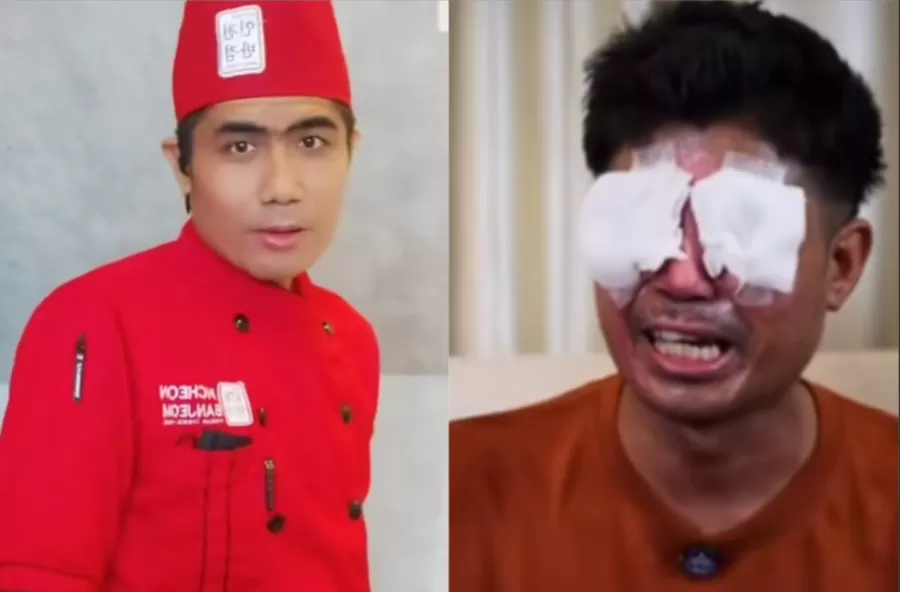 Agus Salim menjadi korban penyiraman air keras.