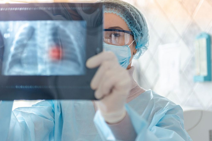 Ilustrasi seorang dokter dengan rontgen penyakit Pneumonia.