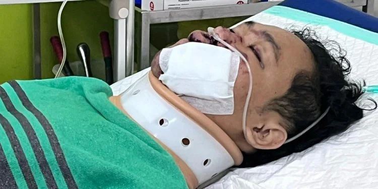 Begini kondisi thoif korban  tabrakan maut di jalan Arteri Soekarno Hatta, Kota Semarang pada 28 Maret 2025