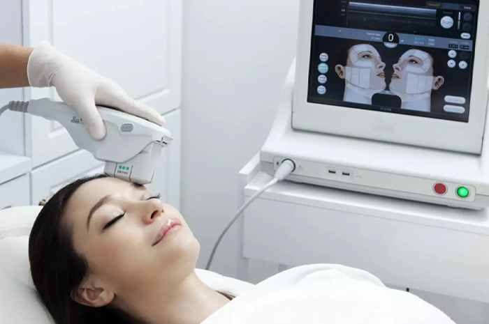 Ultherapy Prime.