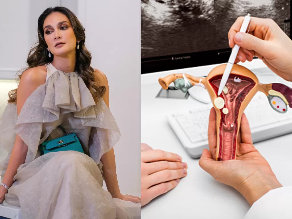 Pembekuan sel telur Luna Maya dilakukan pada tahun 2022 lalu.