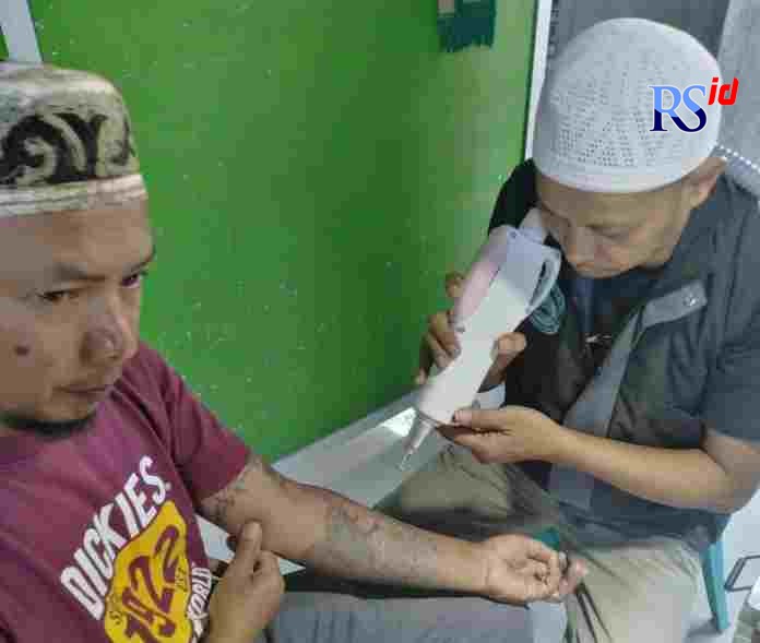 Khilmi bersama timnya menghapus tato di Masjid Al Munawaroh, Salatiga. (Istimewa)