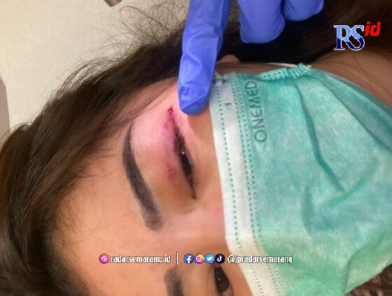 Sepupu dari anak pengacara kondang Hotman Paris Hutapea menjadi korban KDRT. (Istimewa)