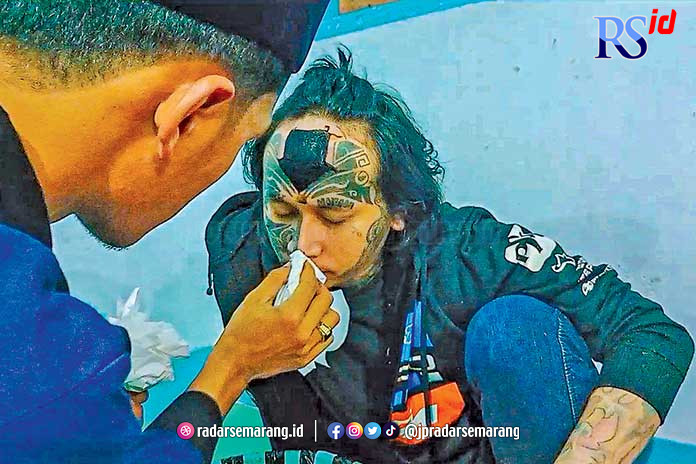 Tim Hapus Tattoo Pondok Pesantren An-Najach Magelang saat melakukan proses penghapusan tato terhadap pasien. (Istimewa)