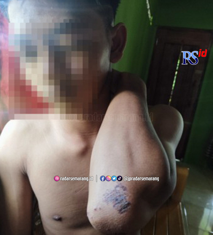 TRAUMA: PMP, korban pengeroyokan di Sukodono, Minggu (7/5/2023) malam. (AHMAD KHAIRUDIN/RADAR SOLO)