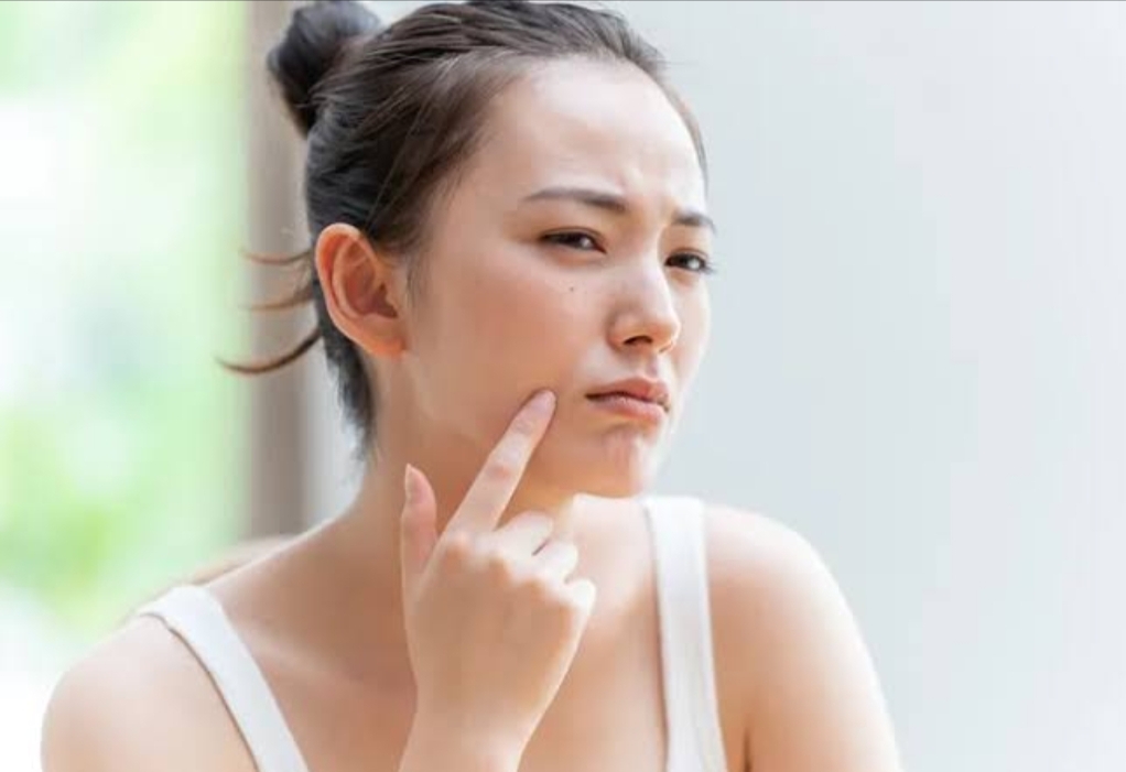 Ilustrasi seseorang yang mengalami kulit sensitif