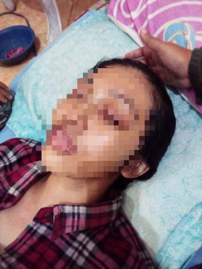 MEMPRIHATINKAN: Kondisi korban Nihayatus Saadah, warga Desa Lenteng Timur, Kecamatan Lenteng, Sumenep, usai mengalami KDRT oleh suaminya. (Istimewa)