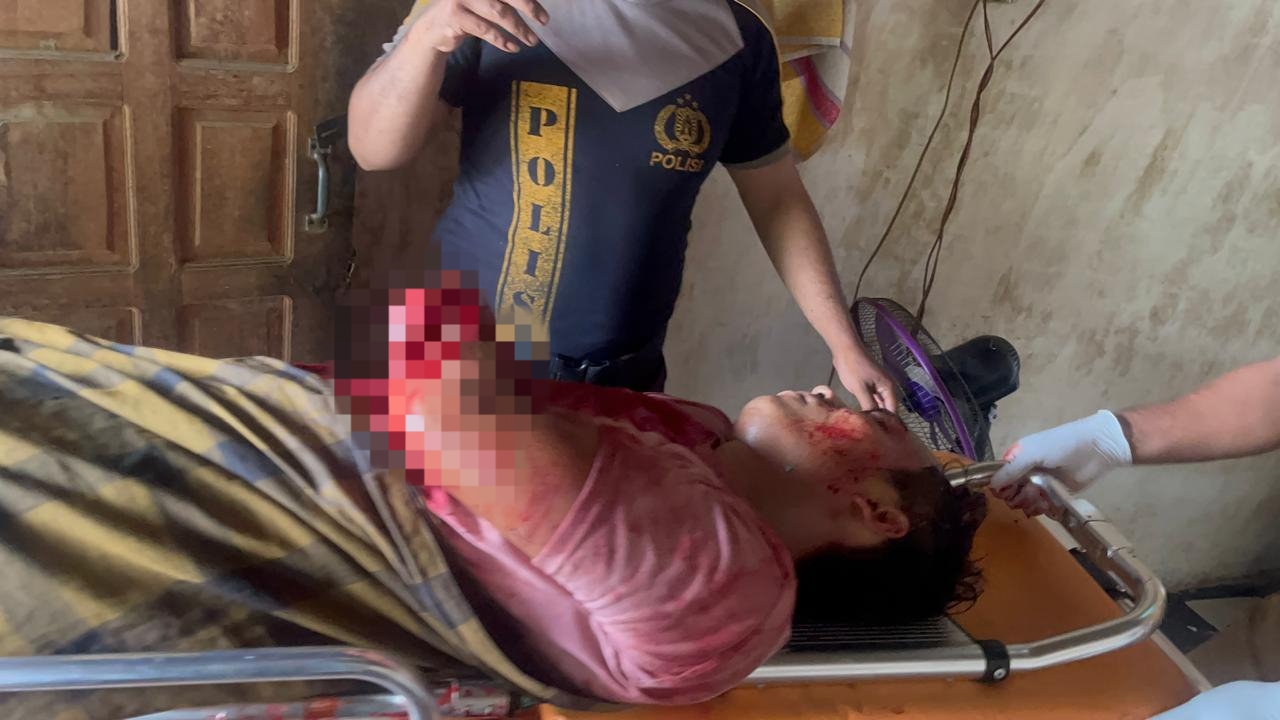TAK SADAR: Korban pembacokan di Desa Tanah Merah Laok, Bangkalan mendapat penanganan medis di RSUD Syamrabu Bangkalan, Selasa (20/1).