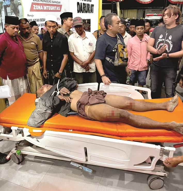 BABAK BELUR: Samhudi dirawat di RSMZ Sampang usai dimassa warga karena hendak melakukan pencurian Jumat (30/1). (HUMAS POLRES UNTUK JPRM)
