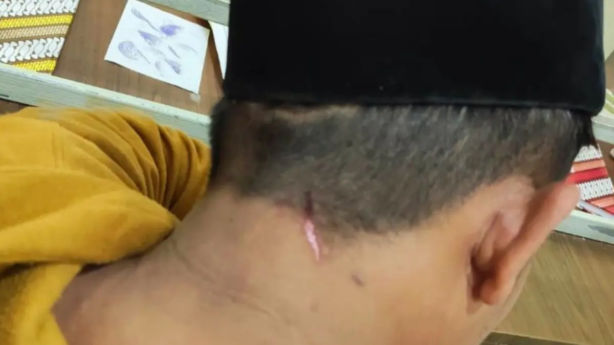 LUKA: Kasus penganiayaan yang menimpa Khalik terjadi di Jalan Raya Pasar Longos, Kecamatan Gapura, pada Jumat (20/2) sore.
