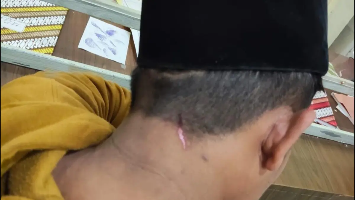 BUKTI KEKERASAN: Khaliq saat mengalami luka di leher belakang akibat dipukul oleh Barri pada Jumat (20/2) sore.
