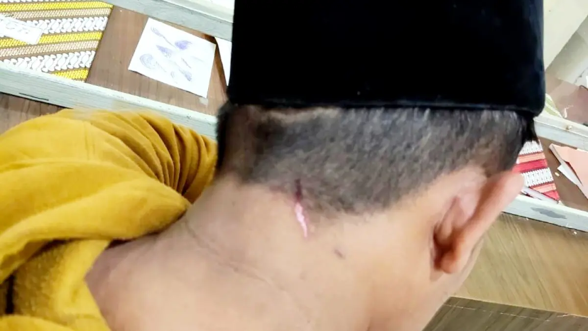 BUKTI KEKERASAN: Khaliq saat mengalami luka di leher belakang akibat dipukul oleh Br pada Jumat (20/2) sore. (IST/JPRM)