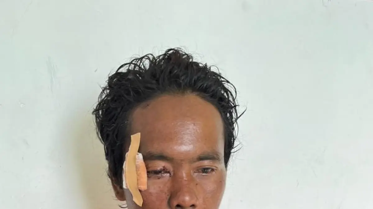 PERISTIWA: Korban sambaran petir mendapat perawatan rawat di Puskesmas Mandangin, Kamis (30/4).