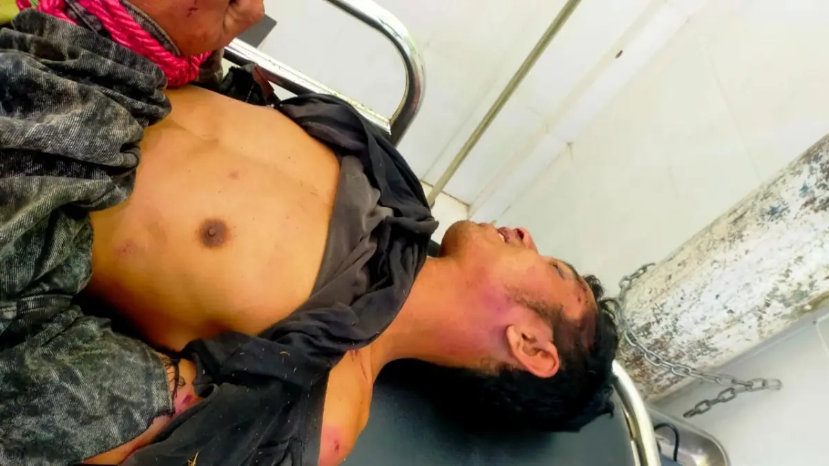 TERGELETAK: Rosi, pelaku curanmor tak berdaya usai digebuki warga, Sabtu (25/7).