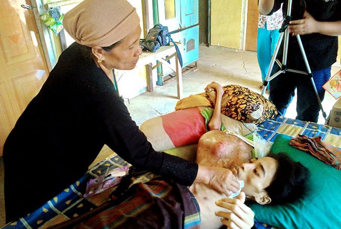 Tiga Bulan Rizal Terbaring Lemah karena Kanker Tulang
