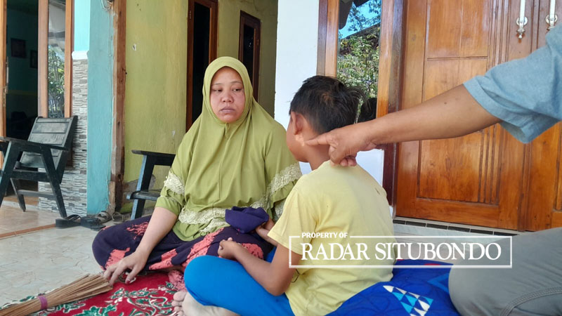 DIDAMPINGI IBU: Yayan (kanan) Paman Rafi Asrof menunjuk penyakit Veteligo yang diderita keponakannya di depan rumahnya di Dusun Setonggek, Desa Seletreng, Kecamatan Kapongan, Selasa (20/8).