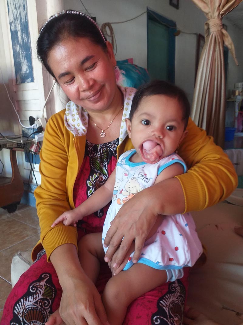 SEGERA OPERASI: Aqilah Azahrah akan segeramenjalani tindakan medis di Surabaya