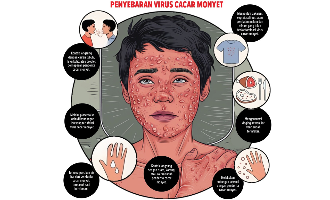 Grafis: Reza Fairuz/Radar Banyuwangi