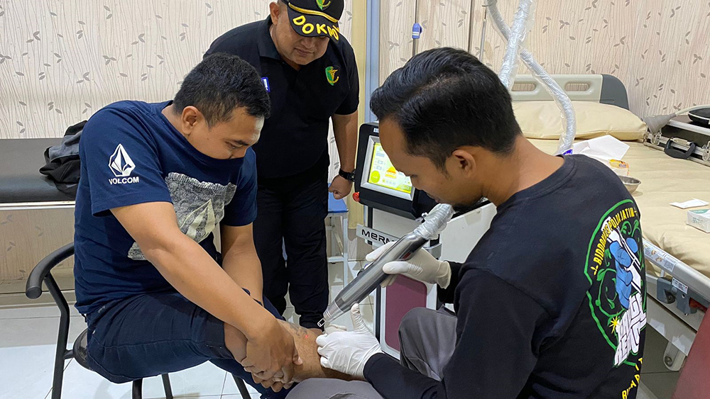 PAKAI LASER: Seorang pria mengikuti program hapus tato gratis di Klinik Pratama Polresta Banyuwangi, Kamis (2/1).
