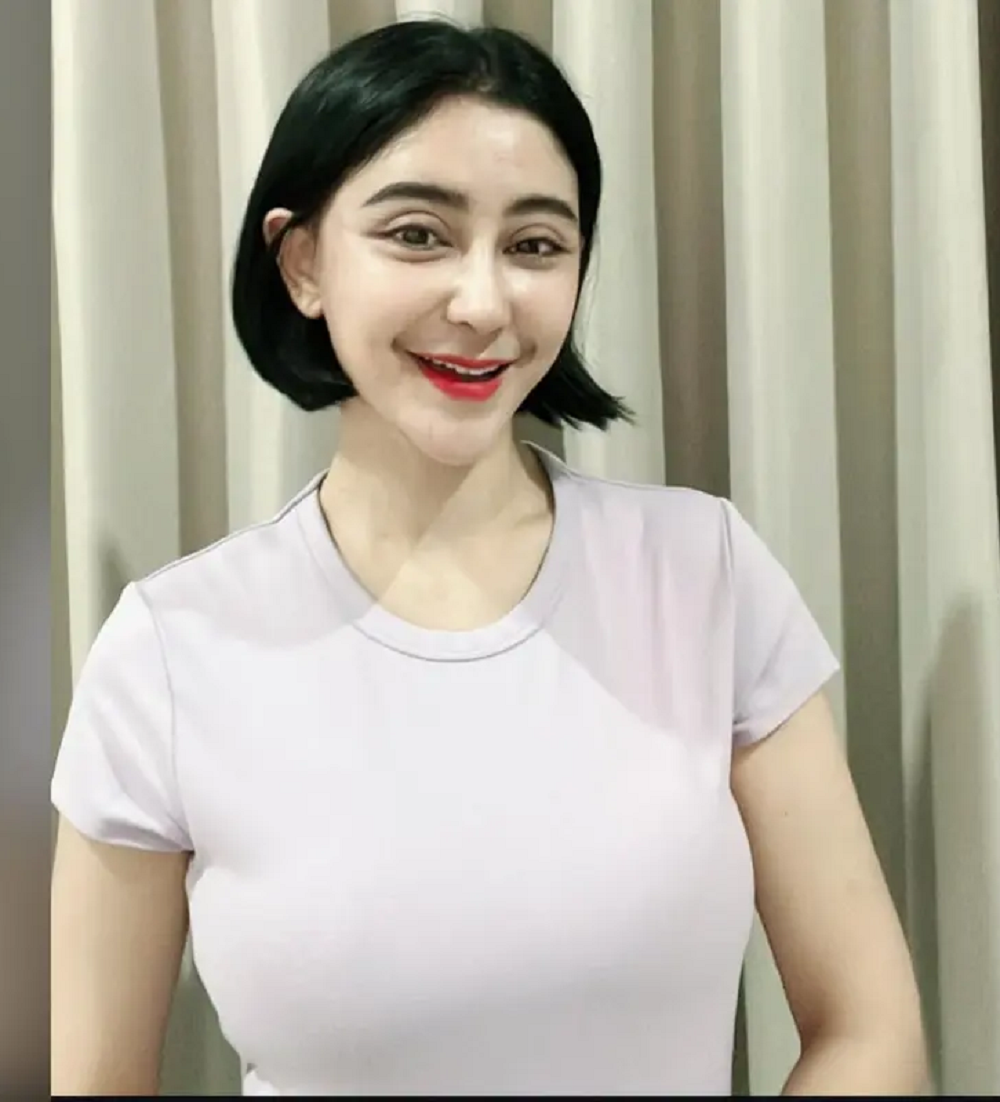 Wajah ayu Uut Permatasari setelah operasi plastik.