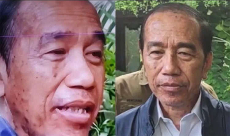 Joko Widodo, Presiden ke-7 Indonesia mengalami alergi kulit sepulang dari Vatikan.