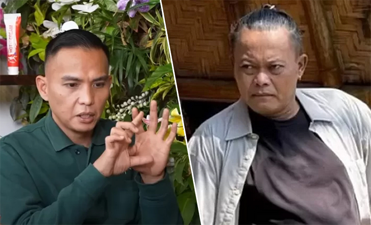 Hard Gumay (kiri). Komedian Sule saat ini sedang dirawat intensif.