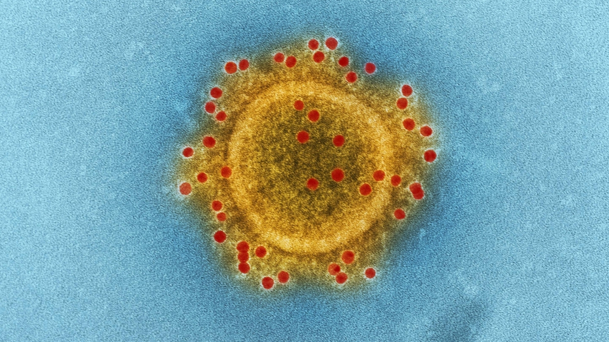 Jepang peringatkan warganya di India soal risiko virus Nipah.