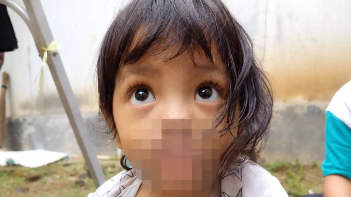 HADAPI KENDALA: Operasi tumor mulut Aqila Azzahrah terkendala biaya akomodasi (Aqila Azzahra)