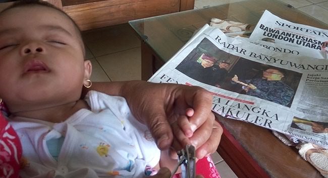 potong-kuku-cegah-infeksi